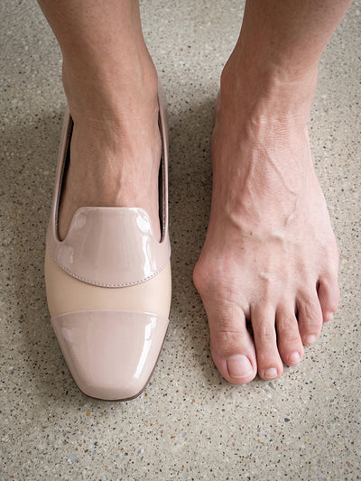 Bunion