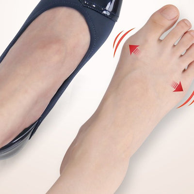 Hallux Valgus