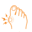 Bunion pressure causes pain